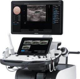 fibroscan